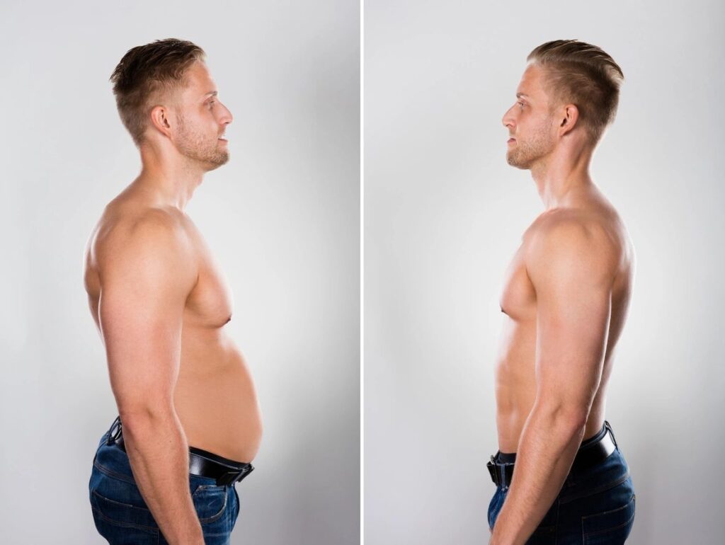 Peptide Therapy for Weight Loss